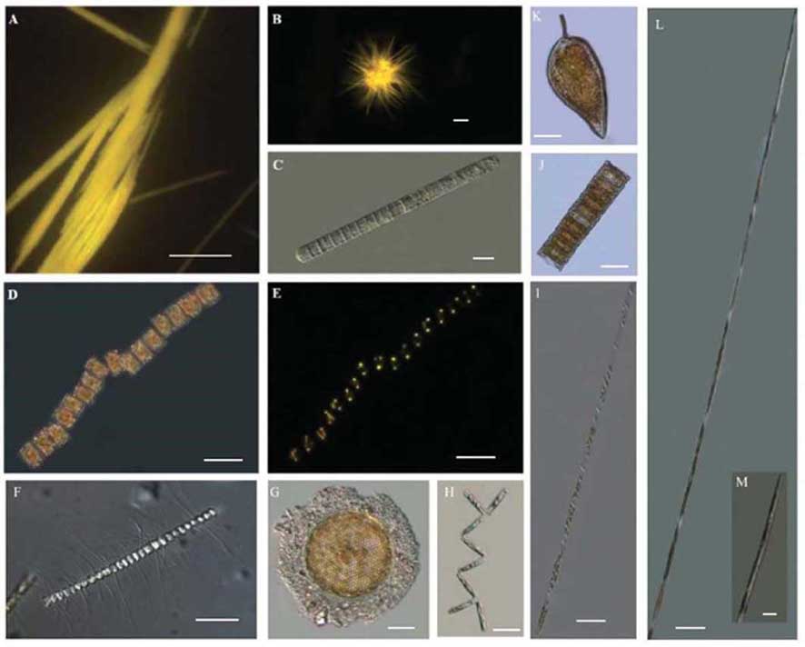 Fotografias de alguns seres do fitoplâncton presentes no canal de São Sebastião